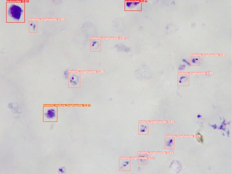 Desenvolupament d’un sistema de diagnòstic automatitzat per la malària i l’esquistosomiasi urogenital utilitzant eines d'intel·ligència artificial i un microscopi robotitzat universal de baix cost