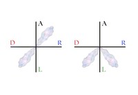 Modeling Explosive Opinion Depolarization in Interdependent Topics