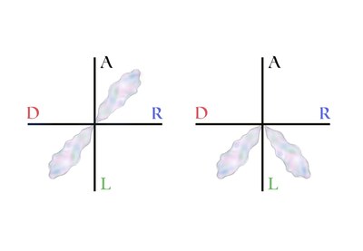 Modeling Explosive Opinion Depolarization in Interdependent Topics